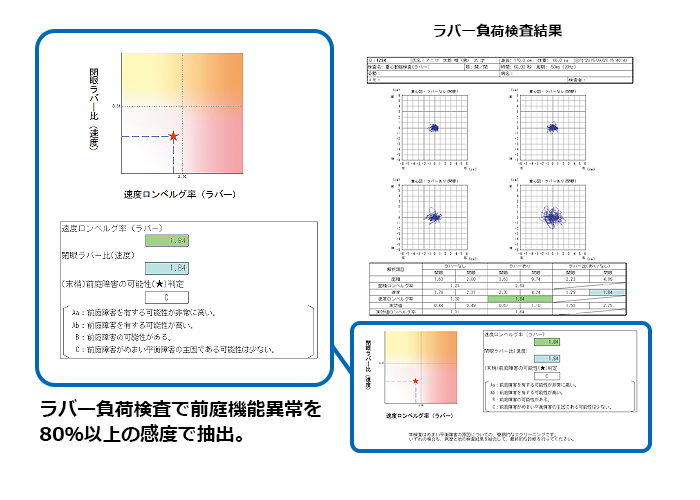 ラバー負荷検査で前庭機能異常を80％以上の感度で抽出。