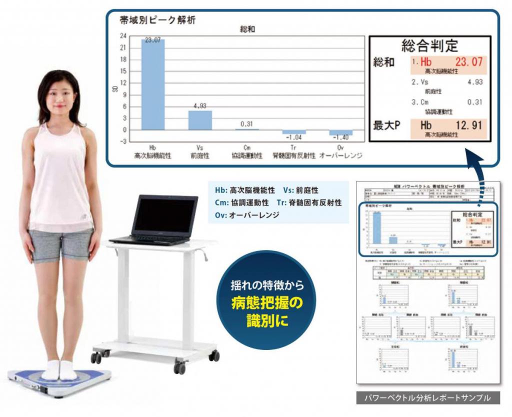 パワーベクトル分析タイプBの特徴