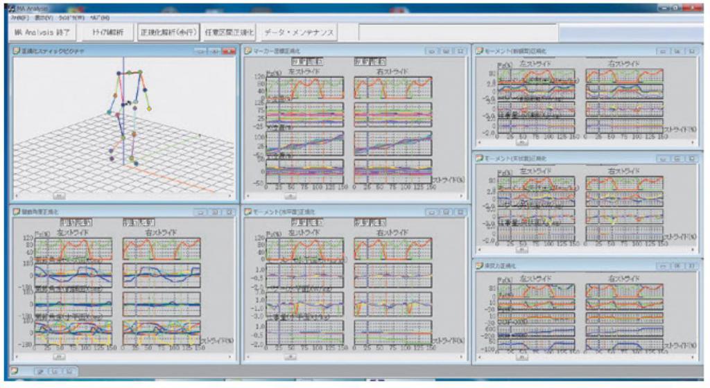 正規化解析(歩行)
